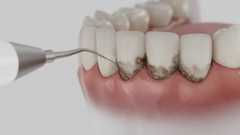 Reliable Dental Implants contractor in Hayesville, OR by Smile Center Dentistry